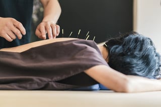 acupuncture.jpg